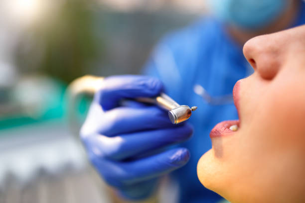 Best Wisdom Tooth Removal  in Belmont, MS